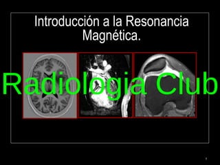 1
Introducción a la Resonancia
Magnética.
Radiologia Club
 