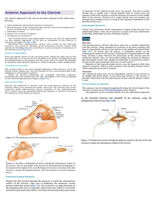 Clavicle fracture | PDF