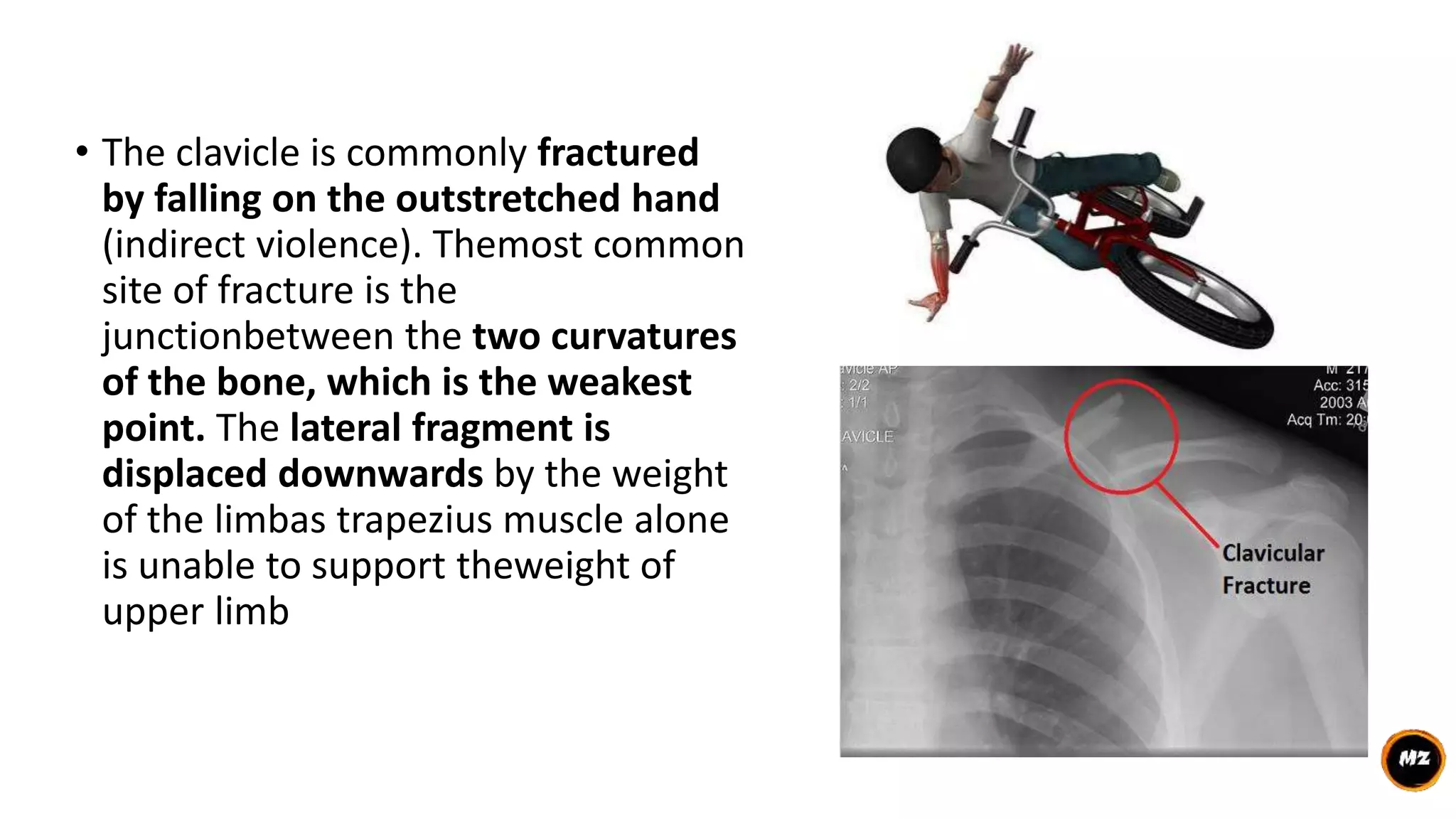 Clavicle | PPTX