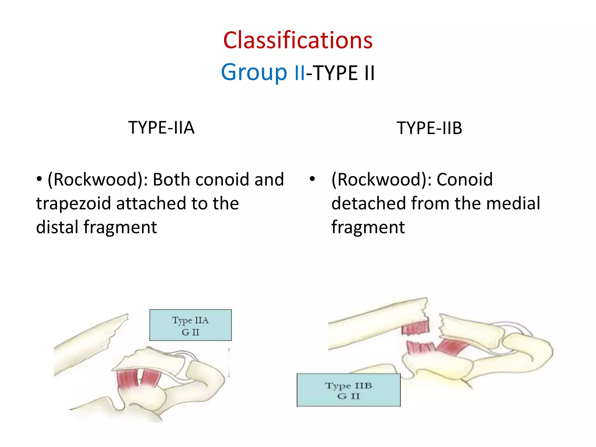 Clavicle and scapular fracture | PPTX