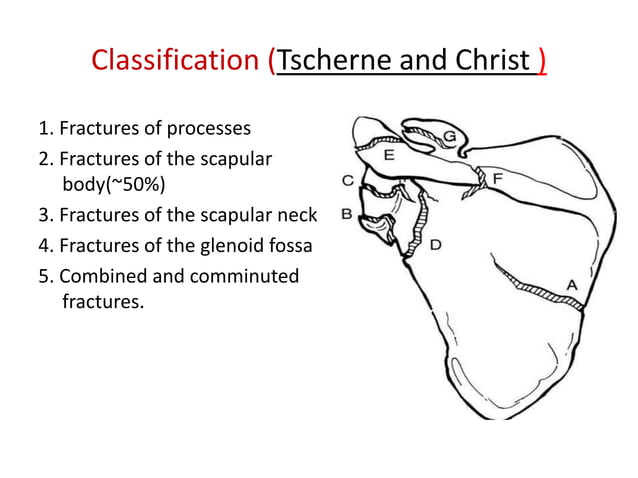 Clavicle and scapular fracture | PPTX