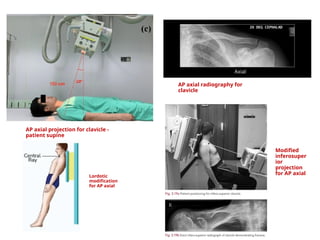CLAVICLE, ACJ and SCJ radiographic technique.pptx
