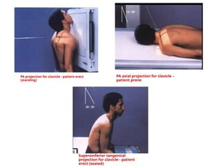 CLAVICLE, ACJ and SCJ radiographic technique.pptx