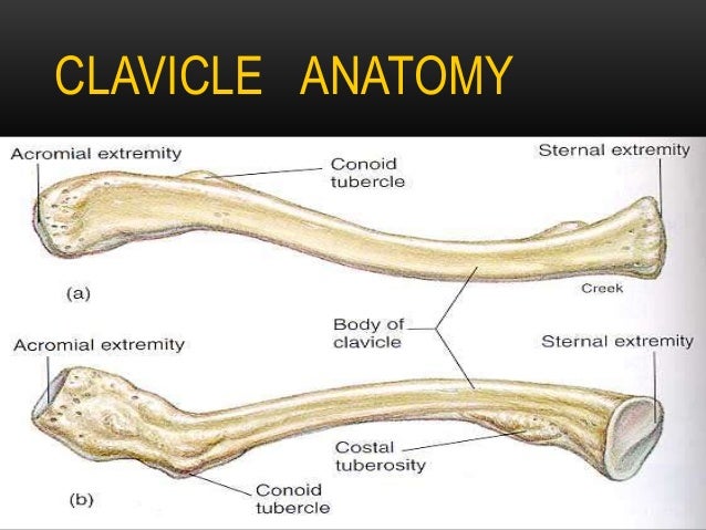 Clavicle fracture