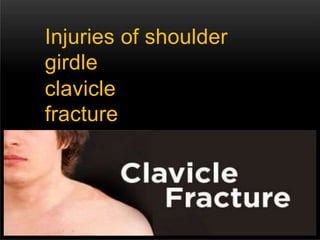 Injuries of shoulder
girdle
clavicle
fracture
scapula
fracture
 