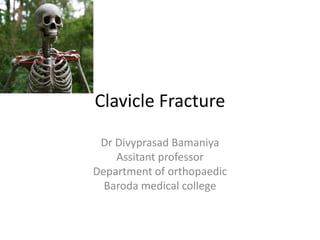 Clavicle Fracture
Dr Divyprasad Bamaniya
Assitant professor
Department of orthopaedic
Baroda medical college
 