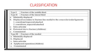 Clavicle fracture | PPTX