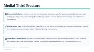 Diagnostic Challenges Fractures near the sternoclavicular articulation are often poorly visualized on standard plain
radiographs, frequently necessitating advanced imaging like CT scans to determine morphology and mediastinal
involvement.
Displacement Risks While relatively rare, these fractures may demonstrate dangerous posterior displacement towards
the mediastinum, presenting immediate risks to underlying vital anatomy.
Associated Complications Requires critical and urgent evaluation due to the proximity of vital structures. Potential
life-threatening complications include tracheal compression, esophageal injury, and great vessel lacerations.
Medial Third Fracture
Ref: Throckmorton TW, Kuhn JE. J Shoulder Elbow Surg.
2007;16(1):49-54.
 
