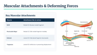 Muscular Attachments & Deforming Forces
Key Muscular Attachments
Muscle Attachment Site & Action
SCM Medial 1/3; Elevates medial fragment
Pectoralis Major Medial 1/2; Pulls medial fragment medially
Deltoid Lateral 1/3; Pulls lateral fragment downwards
Trapezius Lateral 1/3; Ineffective in preventing displacement
 