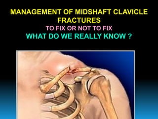 MANAGEMENT OF MIDSHAFT CLAVICLE
FRACTURES
TO FIX OR NOT TO FIX
WHAT DO WE REALLY KNOW ?
 