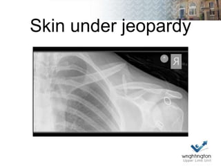 Skin under jeopardy
 
