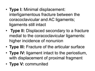 • Type I: Minimal displacement:
interligamentous fracture between the
coracoclavicular and AC ligaments;
ligaments still intact
• Type II: Displaced secondary to a fracture
medial to the coracoclavicular ligaments:
higher incidence of nonunion
• Type III: Fracture of the articular surface
• Type IV: ligament intact to the periostium,
with displacement of proximal fragment
• Type V: communited
 