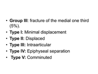 • Group III: fracture of the medial one third
(5%).
• Type I: Minimal displacement
• Type II: Displaced
• Type III: Intraarticular
• Type IV: Epiphyseal separation
• Type V: Comminuted
 