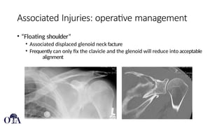 Clavicle Fractures clavicle fracture clavicle | PPTX