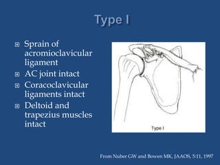 Clavicle fractures&acromio clavicular joint injuries | PPTX