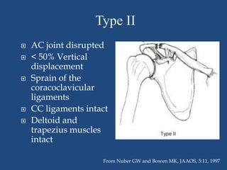 Clavicle fractures&acromio clavicular joint injuries | PPTX