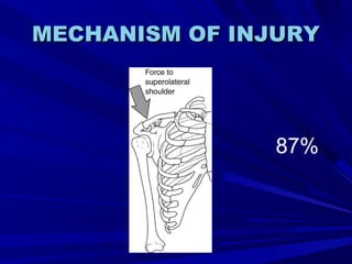 MECHANISM OF INJURYMECHANISM OF INJURY
87%
 