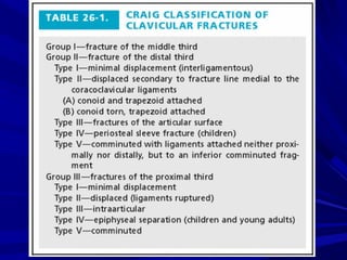 Claviclefrctures