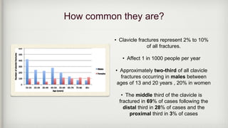 How common they are?
• Clavicle fractures represent 2% to 10%
of all fractures.
• Affect 1 in 1000 people per year
• Approximately two-third of all clavicle
fractures occurring in males between
ages of 13 and 20 years , 20% in women
• The middle third of the clavicle is
fractured in 69% of cases following the
distal third in 28% of cases and the
proximal third in 3% of cases
 