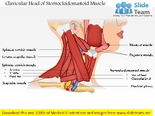 Clavicular Head of Sternocleidomastoid Muscle
•
•
•
•
•
 