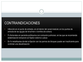 Clavos Endomedulares.pptx