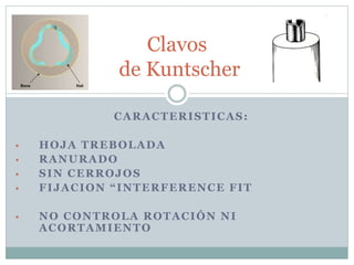 CARACTERISTICAS:
• HOJA TREBOLADA
• RANURADO
• SIN CERROJOS
• FIJACION “INTERFERENCE FIT
• NO CONTROLA ROTACIÓN NI
ACORTAMIENTO
Clavos
de Kuntscher
 