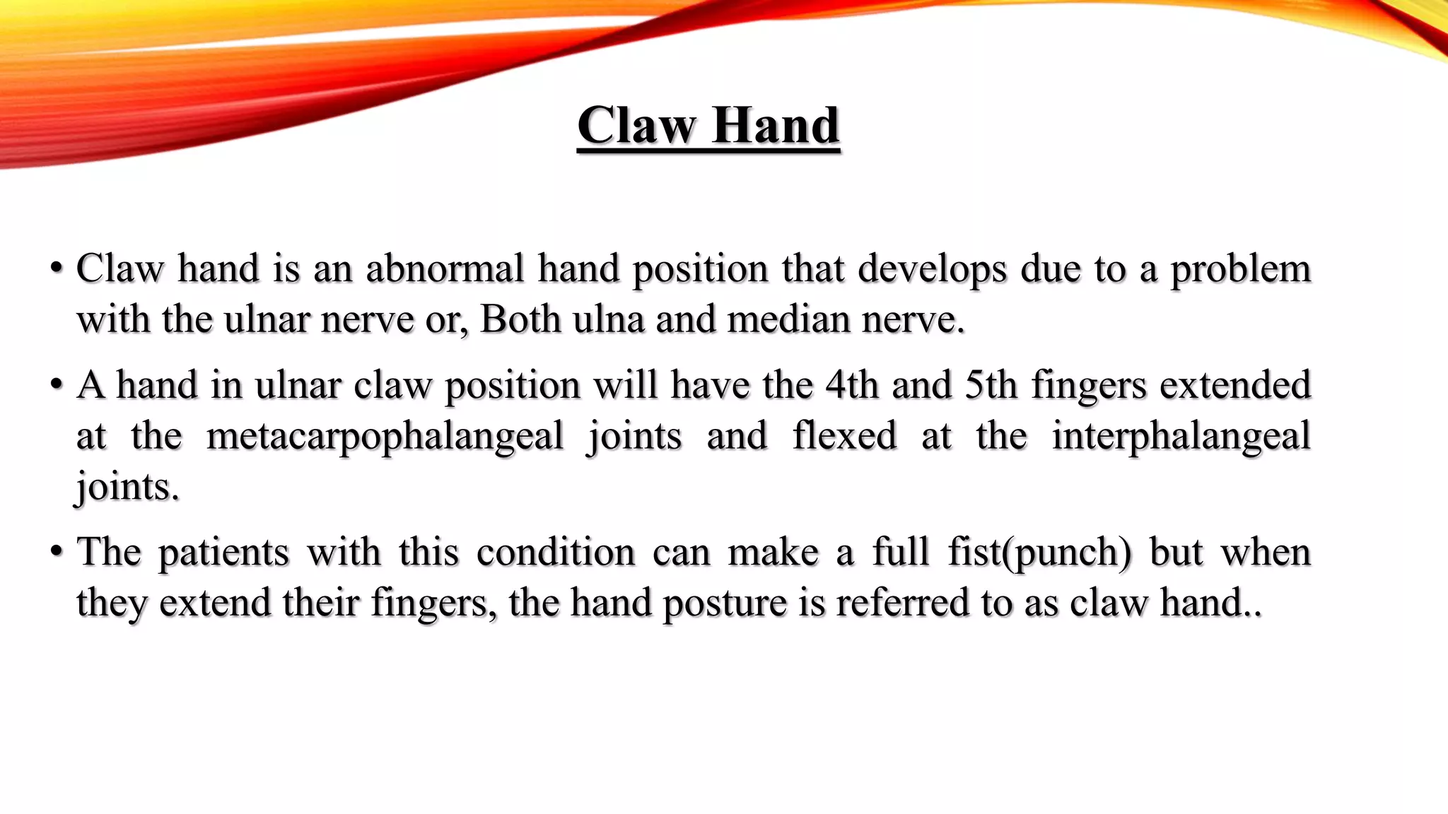 Claw Hand,Definition,Causes,Types,Symptoms and Management