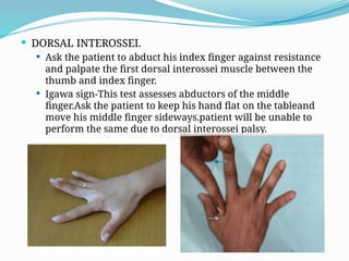 Testing Interossei Strength claw hand 1.pptxhhnjnjnjnj jnjnjnjnjnjnjnjn | PPTX