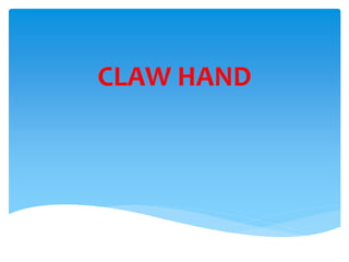 CLAW HAND 
 