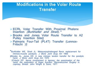 Modifications in the Volar Route 
Transfer 
 ECRL Volar Transfer With Proximal Phalanx 
Insertion (Burkhalter and Strait). * 
 Brooks and Jones Volar Route Transfer to A2 
Pulley Insertion Site‡ 
 Palmaris Four-Tail (PL4T) Transfer (Lennox- 
Fritschi )† 
*Burkhalter WE, Strait JL: Metacarpophalangeal flexor replacement for 
intrinsic-muscle paralysis. J Bone Joint Surg Am 1965 
‡Brooks AL, Jones DS: A new intrinsic tendon transfer for the paralytic 
hand. J Bone Joint Surg Am 1975 
†Fritschi EP: Nerve involvement in leprosy; the examination of the 
hand; the restoration of finger function . Reconstructive Surgery in 
Leprosy , Bristol: John Wright & Sons; 1971 
 
