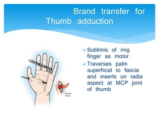 Brand transfer for 
Thumb adduction 
Sublimis of ring 
finger as motor 
Traverses palm 
superficial to fascia 
and inserts on radia 
aspect at MCP joint 
of thumb 
 