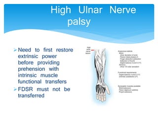 High Ulnar Nerve 
palsy 
Need to first restore 
extrinsic power 
before providing 
prehension with 
intrinsic muscle 
functional transfers 
FDSR must not be 
transferred 
 