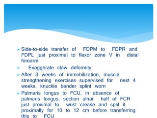  Side-to-side transfer of FDPM to FDPR and 
FDPL just proximal to flexor zone V in distal 
forearm 
 Exaggerate claw deformity 
 After 3 weeks of immobilization, muscle 
strengthening exercises supervised for next 4 
weeks, knuckle bender splint worn 
 Palmaris longus to FCU, in absence of 
palmaris longus, section ulnar half of FCR 
just proximal to wrist crease and split it 
proximally for 10 to 12 cm before transferring 
this to FCU 
 