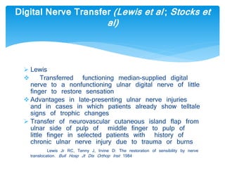 Digital Nerve Transfer (Lewis et al ; Stocks et 
al) 
 Lewis 
 Transferred functioning median-supplied digital 
nerve to a nonfunctioning ulnar digital nerve of little 
finger to restore sensation 
 Advantages in late-presenting ulnar nerve injuries 
and in cases in which patients already show telltale 
signs of trophic changes 
 Transfer of neurovascular cutaneous island flap from 
ulnar side of pulp of middle finger to pulp of 
little finger in selected patients with history of 
chronic ulnar nerve injury due to trauma or burns 
Lewis Jr RC, Tenny J, Irvine D: The restoration of sensibility by nerve 
translocation. Bull Hosp Jt Dis Orthop Inst 1984 
 