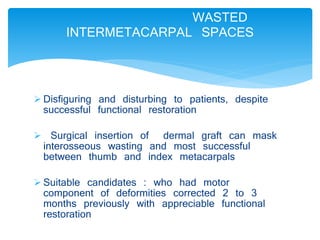 WASTED 
INTERMETACARPAL SPACES 
 Disfiguring and disturbing to patients, despite 
successful functional restoration 
 Surgical insertion of dermal graft can mask 
interosseous wasting and most successful 
between thumb and index metacarpals 
 Suitable candidates : who had motor 
component of deformities corrected 2 to 3 
months previously with appreciable functional 
restoration 
 