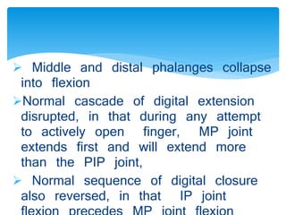  Middle and distal phalanges collapse 
into flexion 
Normal cascade of digital extension 
disrupted, in that during any attempt 
to actively open finger, MP joint 
extends first and will extend more 
than the PIP joint, 
 Normal sequence of digital closure 
also reversed, in that IP joint 
flexion precedes MP joint flexion 
 