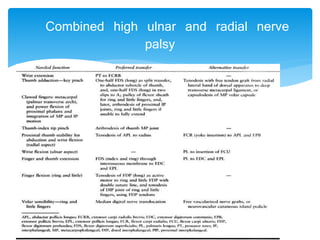 Combined high ulnar and radial nerve 
palsy 
 