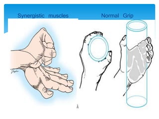 Synergistic muscles Normal Grip 
 