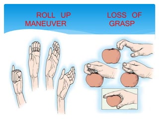 ROLL UP 
MANEUVER 
LOSS OF 
GRASP 
 