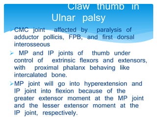 Claw thumb in 
Ulnar palsy 
CMC joint affected by paralysis of 
adductor pollicis, FPB, and first dorsal 
interosseous 
 MP and IP joints of thumb under 
control of extrinsic flexors and extensors, 
with proximal phalanx behaving like 
intercalated bone. 
MP joint will go into hyperextension and 
IP joint into flexion because of the 
greater extensor moment at the MP joint 
and the lesser extensor moment at the 
IP joint, respectively. 
 
