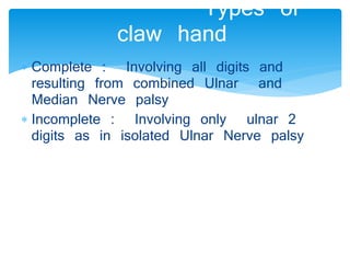Types of 
claw hand 
 Complete : Involving all digits and 
resulting from combined Ulnar and 
Median Nerve palsy 
 Incomplete : Involving only ulnar 2 
digits as in isolated Ulnar Nerve palsy 
 