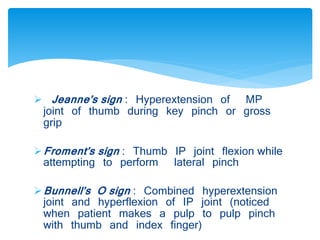  Jeanne’s sign : Hyperextension of MP 
joint of thumb during key pinch or gross 
grip 
Froment’s sign : Thumb IP joint flexion while 
attempting to perform lateral pinch 
Bunnell’s O sign : Combined hyperextension 
joint and hyperflexion of IP joint (noticed 
when patient makes a pulp to pulp pinch 
with thumb and index finger) 
 