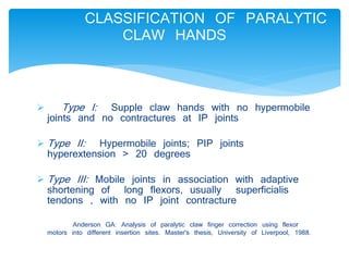 CLASSIFICATION OF PARALYTIC 
CLAW HANDS 
 Type I: Supple claw hands with no hypermobile 
joints and no contractures at IP joints 
Type II: Hypermobile joints; PIP joints 
hyperextension > 20 degrees 
Type III: Mobile joints in association with adaptive 
shortening of long flexors, usually superficialis 
tendons , with no IP joint contracture 
Anderson GA: Analysis of paralytic claw finger correction using flexor 
motors into different insertion sites. Master's thesis, University of Liverpool, 1988. 
 