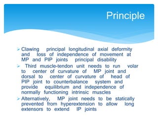 Principle 
 Clawing principal longitudinal axial deformity 
and loss of independence of movement at 
MP and PIP joints principal disability 
 Third muscle-tendon unit needs to run volar 
to center of curvature of MP joint and 
dorsal to center of curvature of head of 
PIP joint to counterbalance system and 
provide equilibrium and independence of 
normally functioning intrinsic muscles 
 Alternatively, MP joint needs to be statically 
prevented from hyperextension to allow long 
extensors to extend IP joints 
 