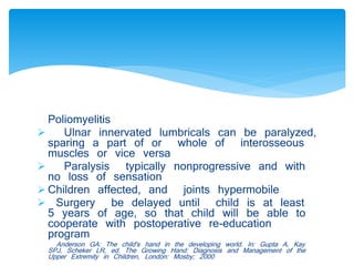 Poliomyelitis 
 Ulnar innervated lumbricals can be paralyzed, 
sparing a part of or whole of interosseous 
muscles or vice versa 
 Paralysis typically nonprogressive and with 
no loss of sensation 
 Children affected, and joints hypermobile 
 Surgery be delayed until child is at least 
5 years of age, so that child will be able to 
cooperate with postoperative re-education 
program 
Anderson GA: The child's hand in the developing world. In: Gupta A, Kay 
SPJ, Scheker LR, ed. The Growing Hand: Diagnosis and Management of the 
Upper Extremity in Children, London: Mosby; 2000 
 