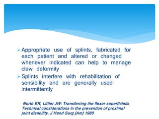 Appropriate use of splints, fabricated for 
each patient and altered or changed 
whenever indicated can help to manage 
claw deformity 
Splints interfere with rehabilitation of 
sensibility and are generally used 
intermittently 
North ER, Littler JW: Transferring the flexor superficialis 
Technical considerations in the prevention of proximal 
joint disability. J Hand Surg [Am] 1980 
 