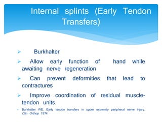 Internal splints (Early Tendon 
 Burkhalter 
 Allow early function of hand while 
awaiting nerve regeneration 
 Can prevent deformities that lead to 
contractures 
 Improve coordination of residual muscle-tendon 
units 
 Burkhalter WE: Early tendon transfers in upper extremity peripheral nerve injury. 
Clin Orthop 1974 
Transfers) 
 