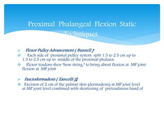 Proximal Phalangeal Flexion Static 
Techniques 
 Flexor Pulley Advancement ( Bunnell ) * 
 Each side of proximal pulley system split 1.5 to 2.5 cm up to 
1.5 to 2.5 cm up to middle of the proximal phalanx. 
 Flexor tendons then “bow string,” to bring about flexion at MP joint 
flexion at MP joint 
 Fasciodermadesis ( Zancolli )‡ 
 Excision of 2 cm of the palmar skin (dermadesis) at MP joint level 
at MP joint level combined with shortening of pretendinous band of 
 