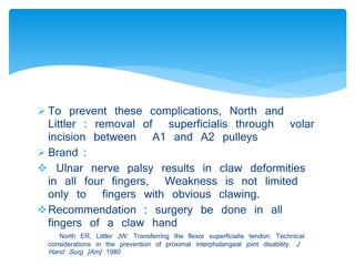  To prevent these complications, North and 
Littler : removal of superficialis through volar 
incision between A1 and A2 pulleys 
 Brand : 
 Ulnar nerve palsy results in claw deformities 
in all four fingers, Weakness is not limited 
only to fingers with obvious clawing. 
Recommendation : surgery be done in all 
fingers of a claw hand 
North ER, Littler JW: Transferring the flexor superficialis tendon: Technical 
considerations in the prevention of proximal interphalangeal joint disability. J 
Hand Surg [Am] 1980 
 