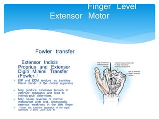 Finger Level 
Extensor Motor 
Fowler transfer 
Extensor Indicis 
Proprius and Extensor 
Digiti Minimi Transfer 
(Fowler ) 
 EIP and EDM tendons as transfers 
lateral bands of the dorsal apparatus 
 May produce excessive tension in 
extensor apparatus and lead to 
intrinsic-plus deformities. 
 May cause reversal of normal 
metacarpal arch and, occasionally, 
extensor weakness in the little finger 
 Fowler SB: Extensor apparatus of the digits 
(abstract). J Bone Joint Surg Br 
 
